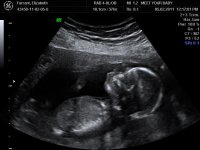 BABY ELIZABETH_10.jpg