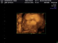 Jennady Ann (19 w 1 d) 005.jpg