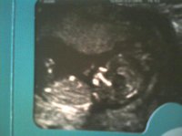 my baby scan.jpg