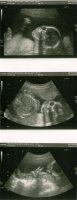 scan 20wks 2days.jpg