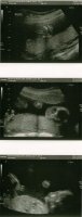 20 wks and 2 days.jpg