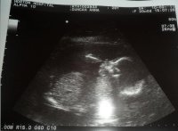 Baby D 20wks.jpg