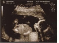 IMG baby scans_0002.jpg