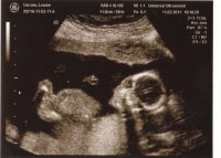 IMG baby scans_0003.jpg