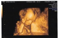 IMG baby scans_0001.jpg