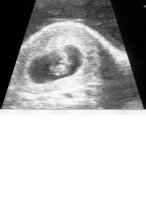 scan2.jpg