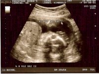 20 weeks face pic-resized.jpg