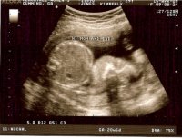 20 week scan pic 2-resized.jpg