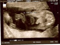 20 week money shot-resized.jpg