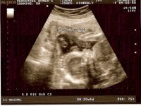 20 week scan pic 4-resized.jpg