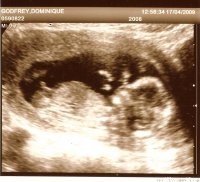 13 weeks.jpg