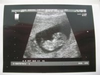 baby.JPG