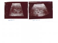 week 11+3 & week 12+5.jpg