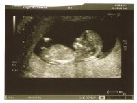 Baby scan 2.jpg