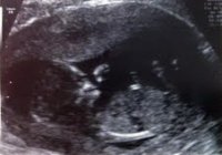 scan.jpg