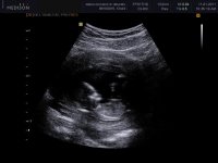 Baby 006.jpg
