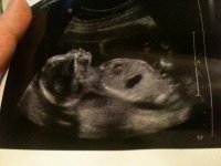 baby1.jpg