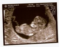 Baby Mulligan.jpg