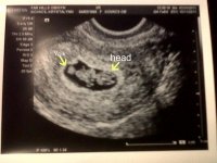 baby8weeks2.jpg