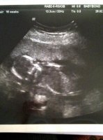 16 week scan.jpg