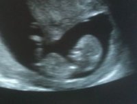 baby 12 weeks crop.jpg