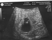 BABY(3)-03-03-11.jpg