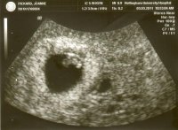 BABY(2)-03-03-11.jpg
