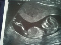 13 Weeks little Rose.jpg