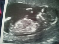 13 Weeks little Rose 1.jpg