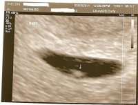 Copy of BabyL6wkspic2.jpg