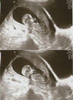 Baby11w5d.jpg