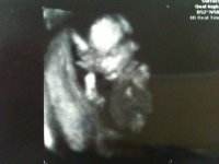 Baby 3d 16 weeks.jpg