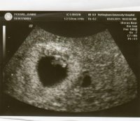 BABY 03-03-11.jpg