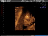 BABY BARNES_17.jpg