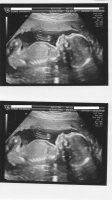 Second Baby Scan 1 & 2.jpg