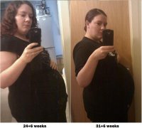 24+6 31+6 weeks.jpg