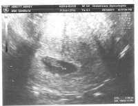8 week ultrasound.jpg