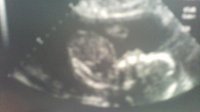 baby 22w2d.jpg