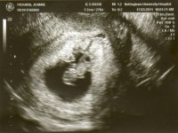 BABY(1)-17-03-2011.jpg