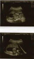 13 week scan - small.jpg