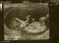 baby number 2!!! xx.jpg
