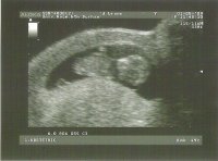 scan 10w5d.jpg