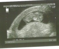 scan 10w5d pic2.jpg