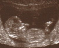 12+6 baby 2 - Copy.jpg