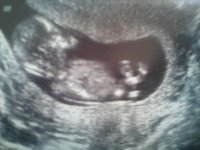 13wks2days.jpg