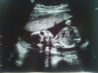 20wks.jpg