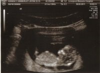 Baby Kenealy.jpg