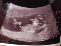 Baby 004.jpg