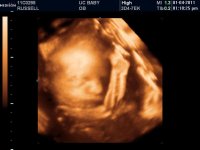 baby with arms around 3.jpg