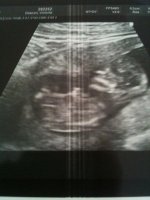 12+5baby.jpg